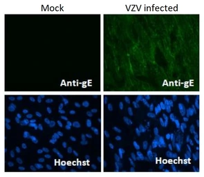 Anti-Varicella Zoster virus gE antibody [#9] used in Immunocytochemistry/ Immunofluorescence (ICC/IF). GTX64187