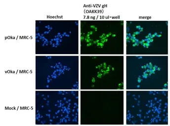 Anti-Varicella Zoster virus gH antibody [OAKK39] used in Immunocytochemistry/ Immunofluorescence (ICC/IF). GTX64188