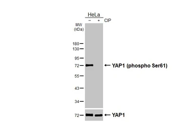 Anti-YAP1 (phospho Ser61) antibody [HL3721] used in Western Blot (WB). GTX641911