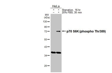 Anti-p70 S6K (phospho Thr389) antibody [HL3738] used in Western Blot (WB). GTX641928
