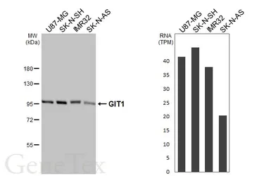 Anti-GIT1 antibody [GT87] used in Western Blot (WB). GTX641942