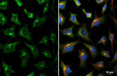 Anti-GALNT2 antibody [HL3746] used in Immunocytochemistry/ Immunofluorescence (ICC/IF). GTX641945