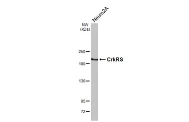 Anti-CDK12 antibody [HL3756] used in Western Blot (WB). GTX641955