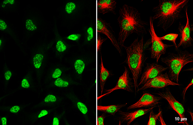 Anti-CDK12 antibody [HL3757] used in Immunocytochemistry/ Immunofluorescence (ICC/IF). GTX641956