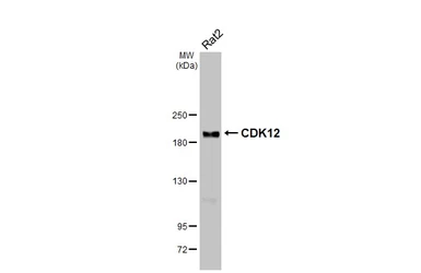 Anti-CDK12 antibody [HL3757] used in Western Blot (WB). GTX641956