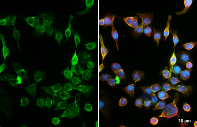 Anti-GPR30 antibody [HL3783] used in Immunocytochemistry/ Immunofluorescence (ICC/IF). GTX642002