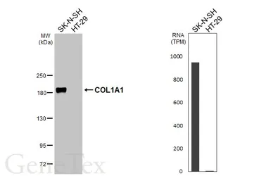 Anti-COL1A1 antibody [GT91] used in Western Blot (WB). GTX642024