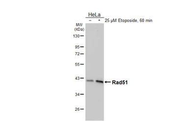 Anti-Rad51 antibody [HL3807] used in Western Blot (WB). GTX642031