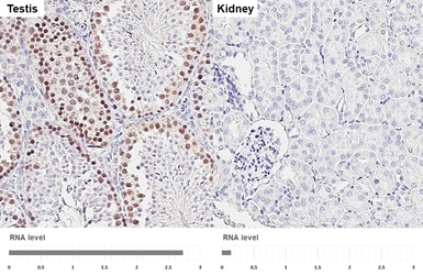 Anti-Rad51 antibody [HL3807] used in IHC (Paraffin sections) (IHC-P). GTX642031
