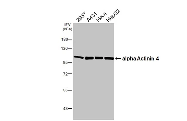 Anti-alpha Actinin 4 antibody [GT95] used in Western Blot (WB). GTX642060