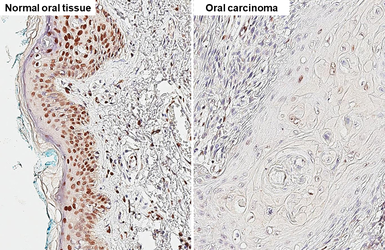 Anti-Histone H1.0 antibody [HL3841] used in IHC (Paraffin sections) (IHC-P). GTX642075