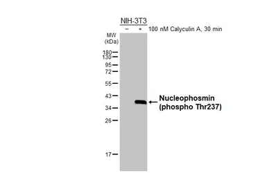Anti-Nucleophosmin (phospho Thr237) antibody [HL3855] used in Western Blot (WB). GTX642089