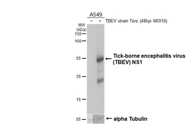 Anti-Tick-borne encephalitis virus (TBEV) NS1 antibody [HL3904] used in Western Blot (WB). GTX642145