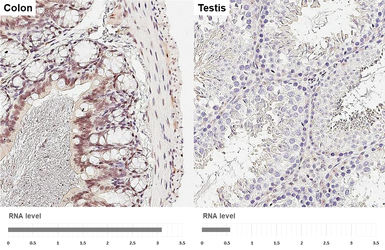 Anti-Ataxin 1 antibody [GT106] used in IHC (Paraffin sections) (IHC-P). GTX642154