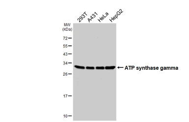 Anti-ATP synthase gamma antibody [HL3949] used in Western Blot (WB). GTX642199