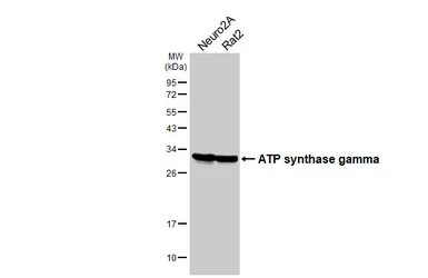 Anti-ATP synthase gamma antibody [HL3949] used in Western Blot (WB). GTX642199