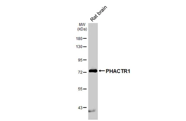 Anti-PHACTR1 antibody [HL3954] used in Western Blot (WB). GTX642204
