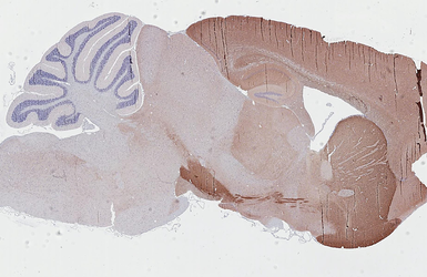 Anti-PHACTR1 antibody [HL3954] used in IHC (Paraffin sections) (IHC-P). GTX642204