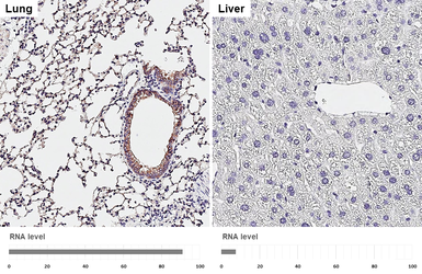 Anti-ENaC Alpha antibody [HL3980] used in IHC (Paraffin sections) (IHC-P). GTX642306