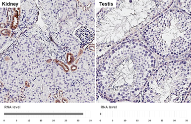 Anti-ENaC Alpha antibody [HL3980] used in IHC (Paraffin sections) (IHC-P). GTX642306