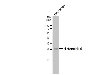 Anti-Histone H1.0 antibody [HL3982] used in Western Blot (WB). GTX642308
