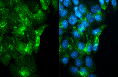 Anti-Adenosine A1 Receptor antibody [HL3987] used in Immunocytochemistry/ Immunofluorescence (ICC/IF). GTX642313