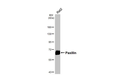 Anti-Paxillin antibody [HL4001] used in Western Blot (WB). GTX642332