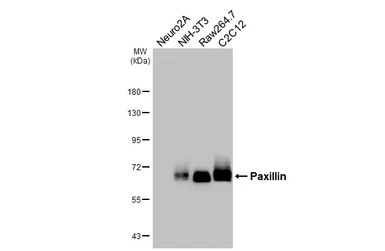 Anti-Paxillin antibody [HL4001] used in Western Blot (WB). GTX642332