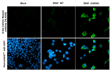 Anti-B-Raf (G469A Mutant) antibody [HL4008] used in Immunocytochemistry/ Immunofluorescence (ICC/IF). GTX642339