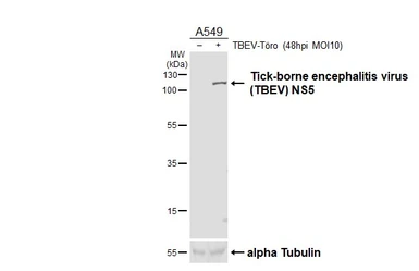 Anti-Tick-borne encephalitis virus (TBEV) NS5 antibody [HL4061] used in Western Blot (WB). GTX642476
