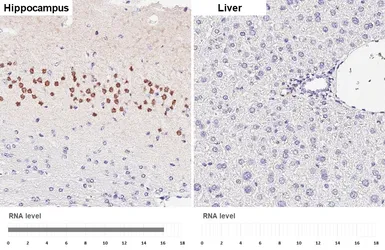 Anti-MATH2 antibody [HL4081] used in IHC (Paraffin sections) (IHC-P). GTX642520