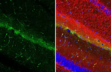 Anti-Latrophilin 2 antibody [HL4090] used in IHC (Paraffin sections) (IHC-P). GTX642529