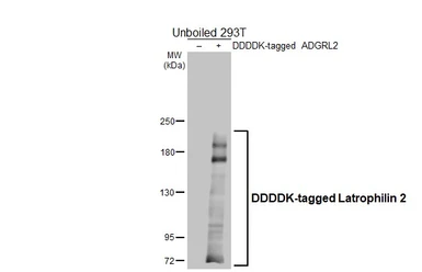 Anti-Latrophilin 2 antibody [HL4090] used in Western Blot (WB). GTX642529