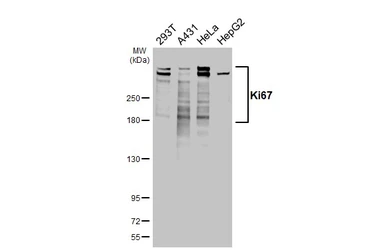 Anti-Ki67 antibody [HL4117] used in Western Blot (WB). GTX642563