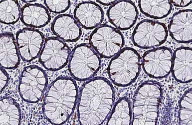 Anti-Ki67 antibody [HL4117] used in IHC (Paraffin sections) (IHC-P). GTX642563
