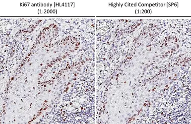 Anti-Ki67 antibody [HL4117] used in IHC (Paraffin sections) (IHC-P). GTX642563
