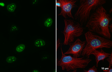 Anti-Ki67 antibody [HL4117] used in Immunocytochemistry/ Immunofluorescence (ICC/IF). GTX642563