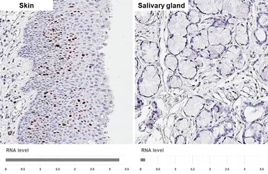 Anti-Ki67 antibody [HL4117] used in IHC (Paraffin sections) (IHC-P). GTX642563