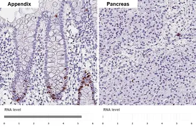 Anti-Ki67 antibody [HL4117] used in IHC (Paraffin sections) (IHC-P). GTX642563