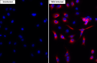 Anti-Tick-borne encephalitis virus (TBEV) NS3 antibody [HL4153] used in Immunocytochemistry/ Immunofluorescence (ICC/IF). GTX642958