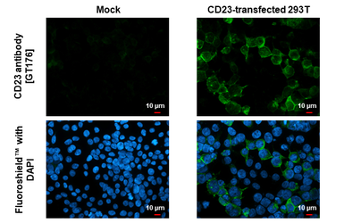 Anti-CD23 antibody [GT176] used in Immunocytochemistry/ Immunofluorescence (ICC/IF). GTX643014