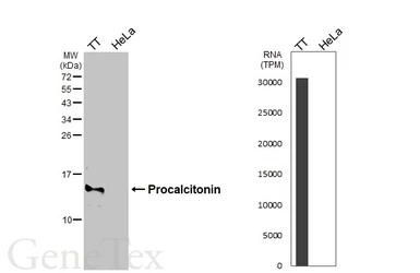 Anti-Procalcitonin antibody [HL4214] used in Western Blot (WB). GTX643036