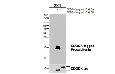 Anti-Procalcitonin antibody [HL4214] used in Western Blot (WB). GTX643036