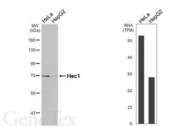 Anti-Hec1 antibody [HL4223] used in Western Blot (WB). GTX643045