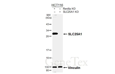 Anti-SLC25A1 antibody [HL4228] used in Western Blot (WB). GTX643061