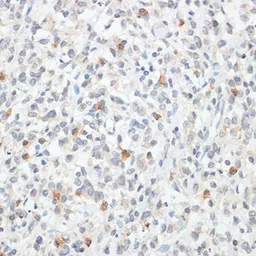 Anti-FOXP3 antibody used in IHC (Paraffin sections) (IHC-P). GTX64343