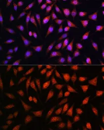 Anti-STAT1 antibody used in Immunocytochemistry/ Immunofluorescence (ICC/IF). GTX64344