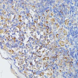 Anti-STAT1 antibody used in IHC (Paraffin sections) (IHC-P). GTX64344