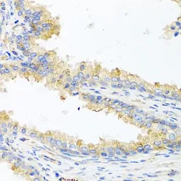 Anti-Apolipoprotein E antibody used in IHC (Paraffin sections) (IHC-P). GTX64352