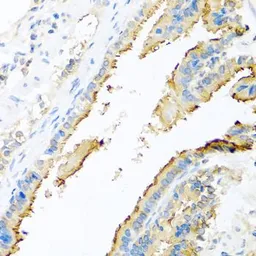 Anti-Apolipoprotein E antibody used in IHC (Paraffin sections) (IHC-P). GTX64352